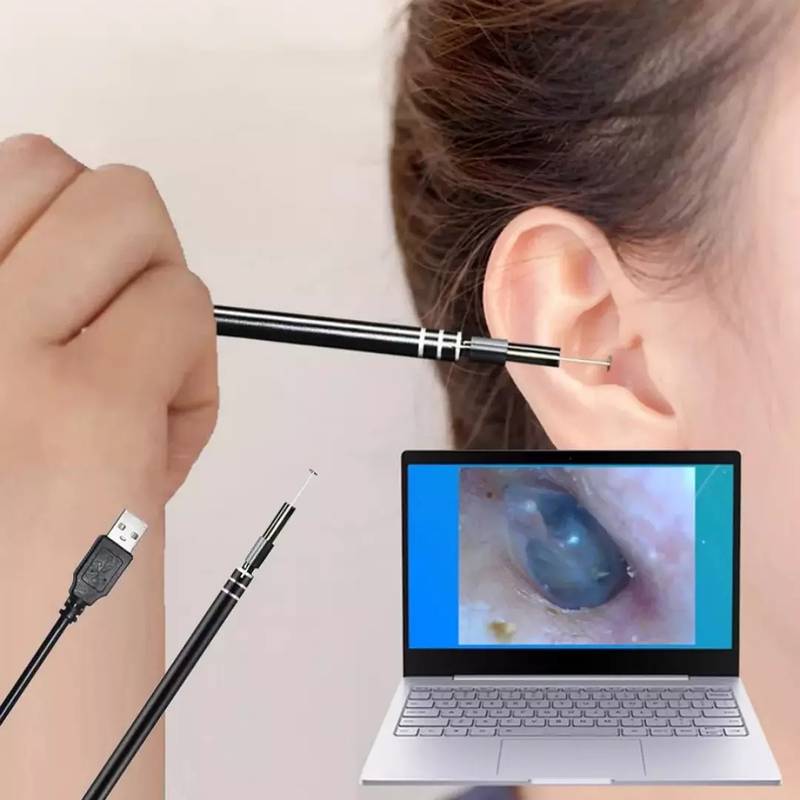 Imported USB Ear Cleaning Tool HD Camera 3