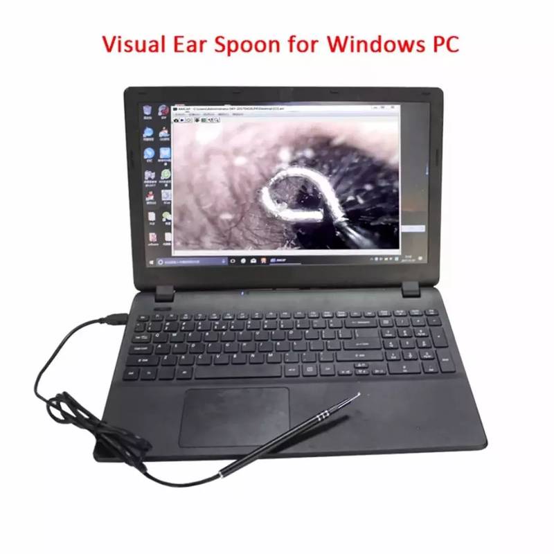 Imported USB Ear Cleaning Tool HD Camera 4