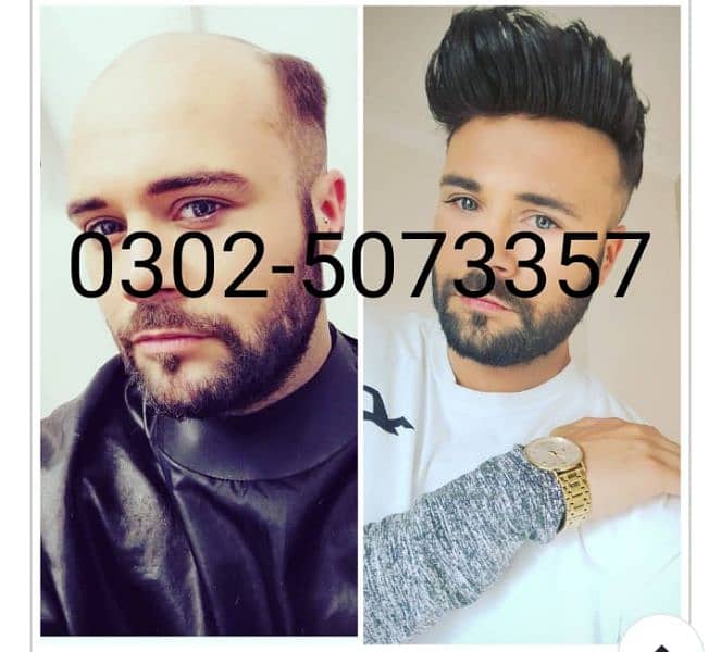 Hair wigs hair unit hair patch sale in Karachi. 3