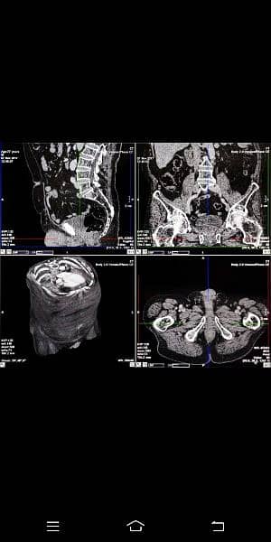 CT scan and MRI scan 1