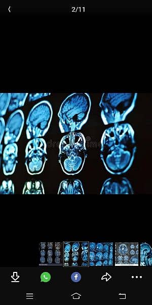 CT scan and MRI scan 3