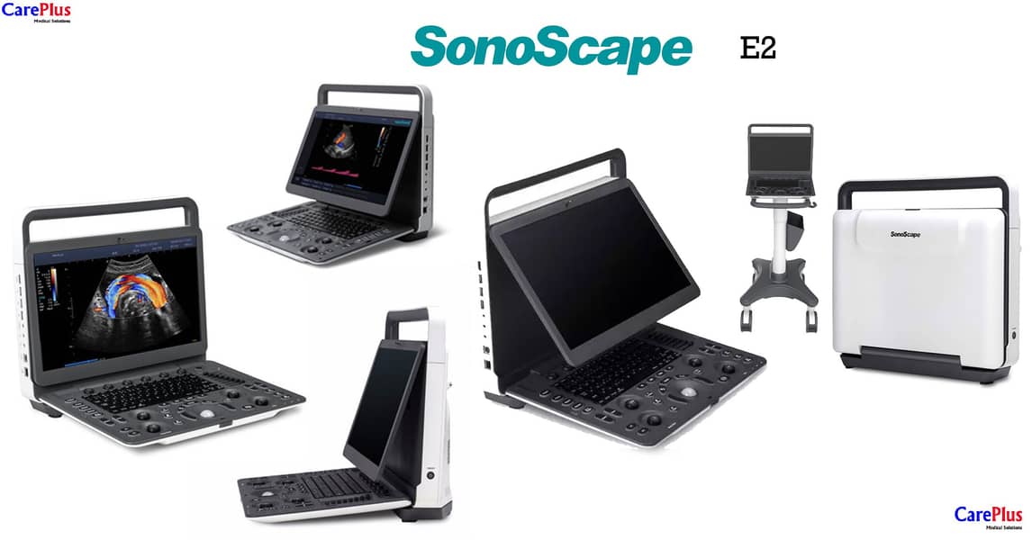 Ultrsound machine SonoScape 1