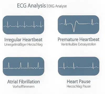 ViaTom HeartMate Handheld ECG Monitor Original 5