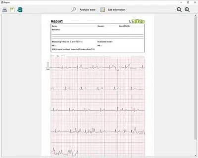 ViaTom HeartMate Handheld ECG Monitor Original 7