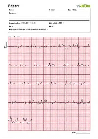 ViaTom HeartMate Handheld ECG Monitor Original 8