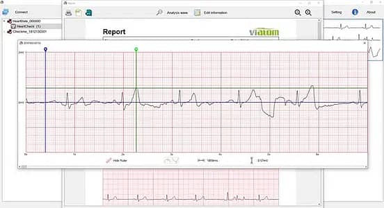 ViaTom HeartMate Handheld ECG Monitor Original 9