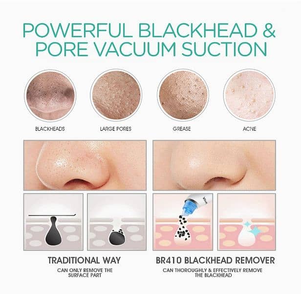 VOYOR Blackhead Remover Pore Vacuum, Acne White Heads Removal BR410 1