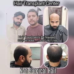 Hair System/Wig Hair Patch/Hair Unit/Hair Patch/Hair Extension