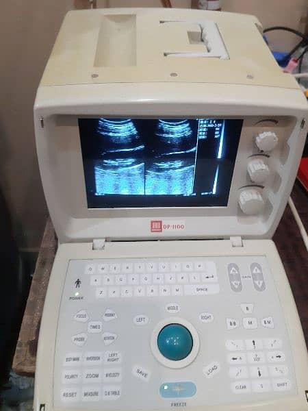 Cheap Price Used  Chinese Portable Ultrasound machine 7