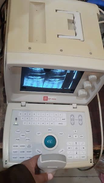 Cheap Price Used  Chinese Portable Ultrasound machine 4