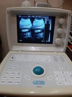 Cheap Price Used  Chinese Portable Ultrasound machine