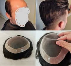 Hair patch