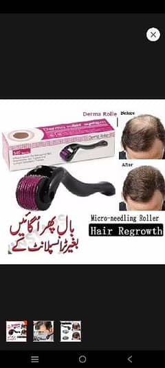 Derma Roller for hair problem