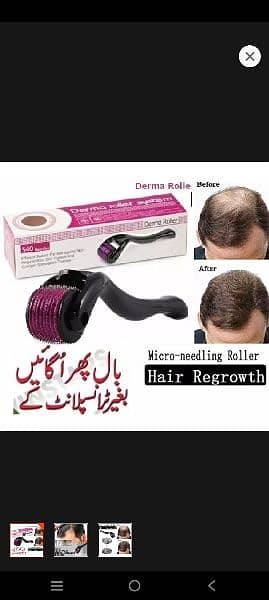 Derma Roller for hair problem 0