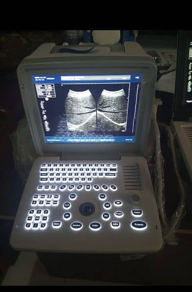 Ultrasound Machine Heavy Quality with Battery Backup | In Karachi 6