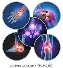 Physiotherapy (Home Service) contact now olx chat/whatsapp 4