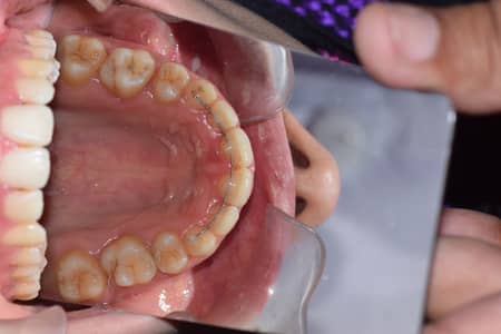 female dentist required