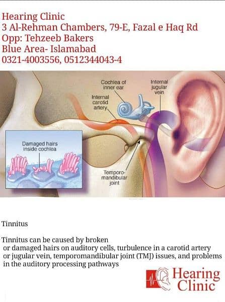 Tinnitus Assessments l Tinnitus Problems 3