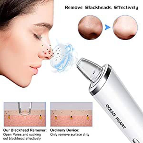 Ocean Heart Electric Pore Cleaner Blackhead Vacuum,Removes Pimples 15