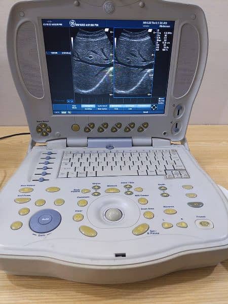 Ultrasound machines, 03333338596 1