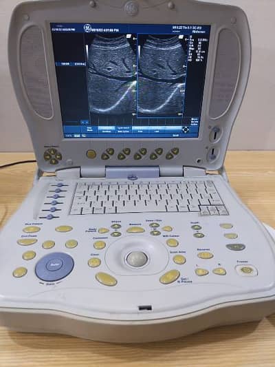 Ultrasound Machine New Stock Available 03333338596 8