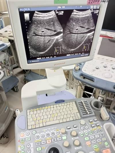 Ultrasound Machine New Stock Available 03333338596 10