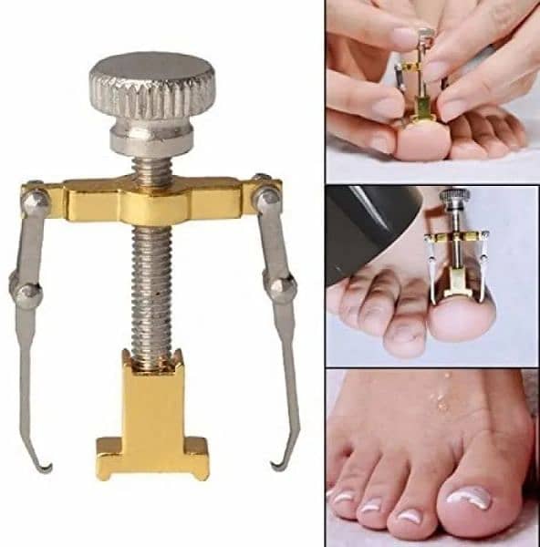 Ingrown Toe Nail Correction Kit Pedicure Toes Treatment Tools Set 0