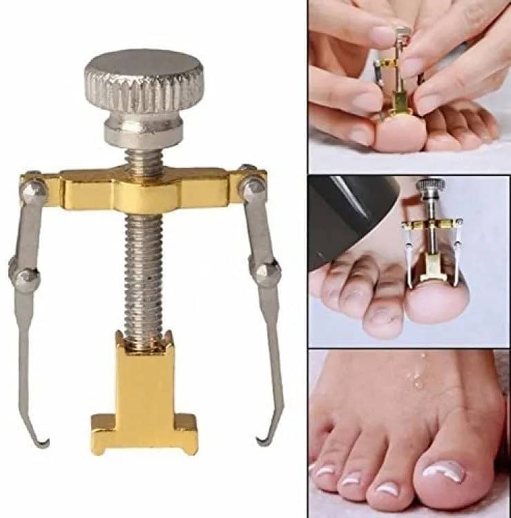 Ingrown Toe Nail Correction Kit Pedicure Toes Treatment Tools 0