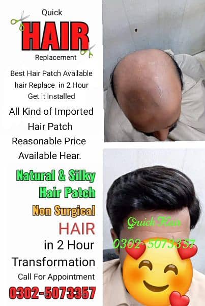 Hair wigs hair unit hair patch sale in Karachi. 1