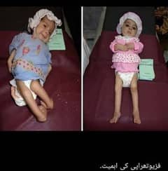 PHYSIOTHERAPY