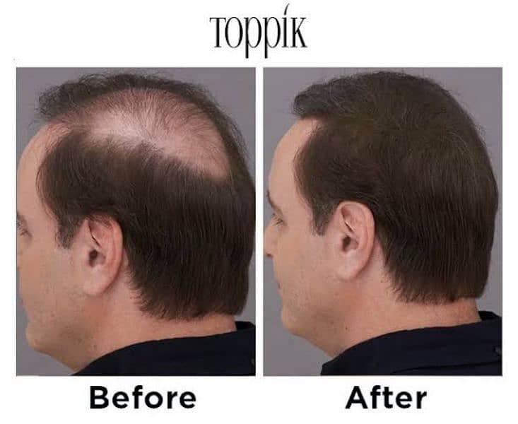 toppik hair fiber only 999 1
