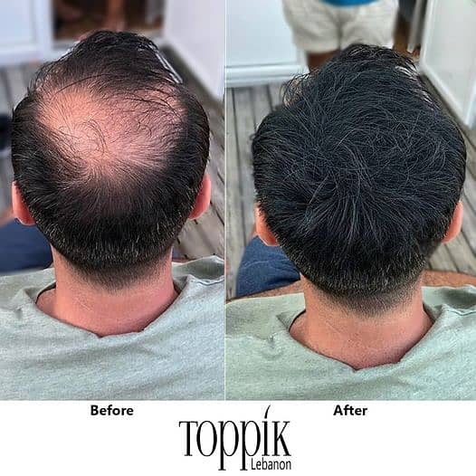 Toppik Hair Building Fibers 3