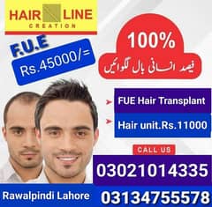 FUE Hair restoration hair units prp