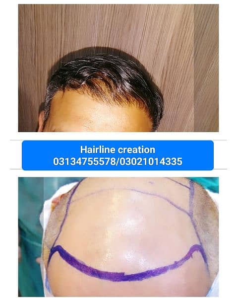 Hair extensions wefted hair hair patch 9