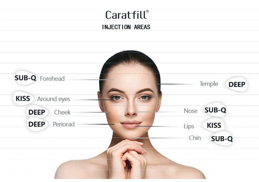 FILLERS WITH LIDOCAINE CROSS LINKED HYALURONICACID 2