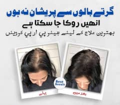 Hair PRP treatment for hair falls