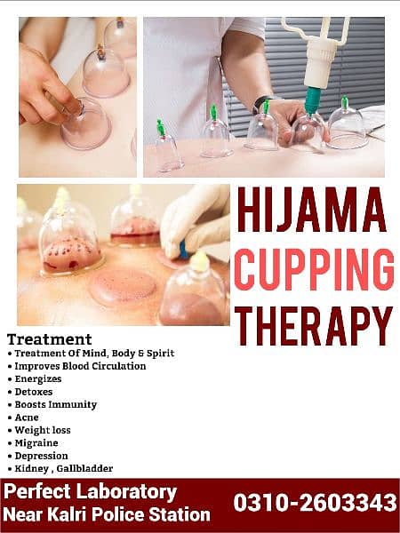 Hijama Cupping Therapy Service 3