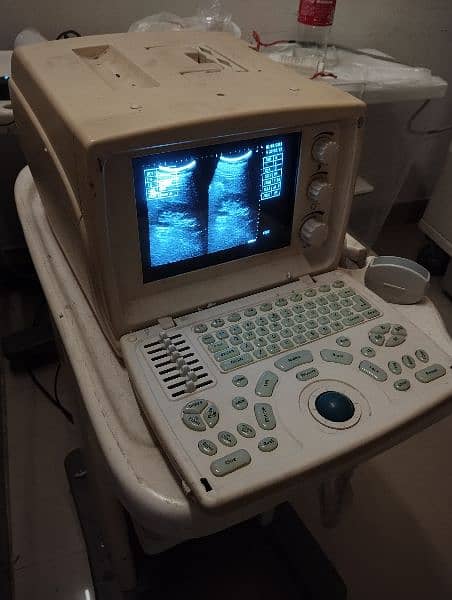 USED NOVADEX 3300 ULTRASOUND MACHINE WITH ONE YEAR WARRANTY 0