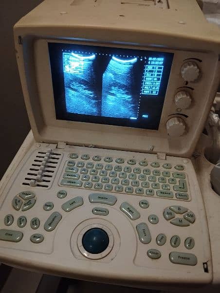 USED NOVADEX 3300 ULTRASOUND MACHINE WITH ONE YEAR WARRANTY 1