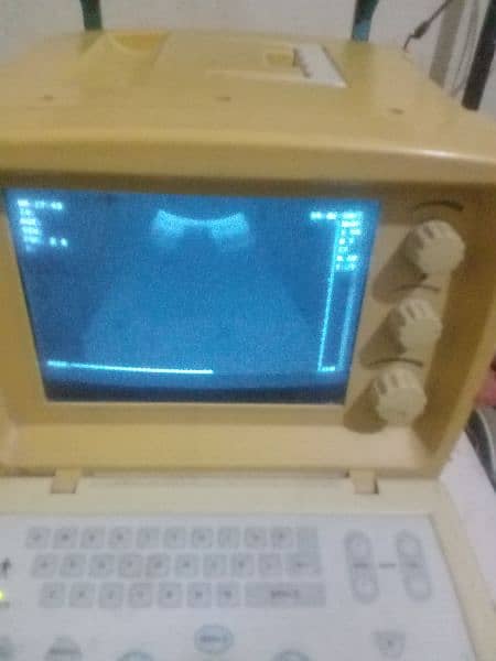 ultrasond machine 0