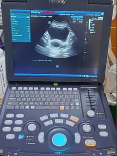 Mindray dp-18 Ultrasound Machine