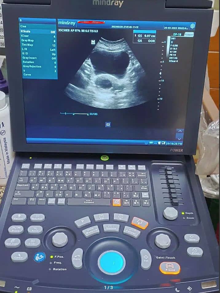Mindray dp-18 Ultrasound Machine 0