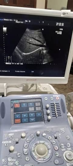 Ultrasound.