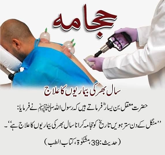 Hijama in Sialkot 4