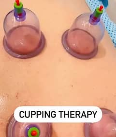 cupping