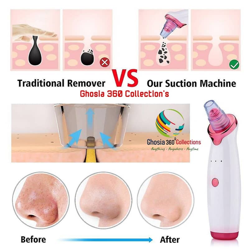 Electric Blackhead Remover Vacuum Acne Cleaner Black Spots Removal 4