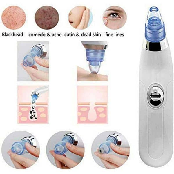 DermaSuction Vacuum Pore Cleaning Device With 4 Suction Heads 7