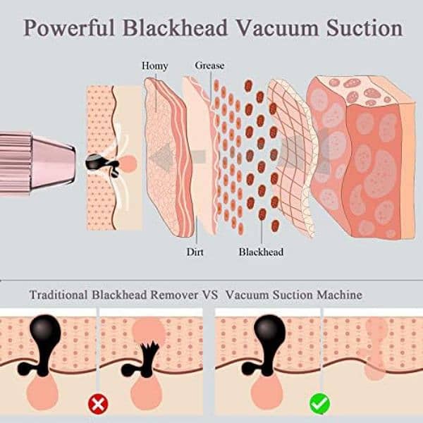 Mosen Blackhead Remover Vacuum Rechargeable LED display 4modes 5probes 1