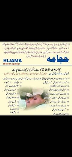 Hijama ( cupping therapy) free home session