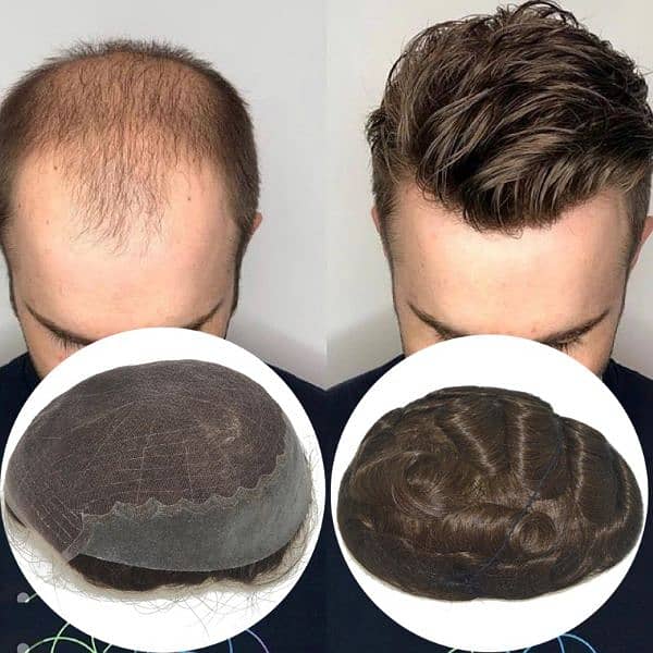 men wig imported quality_hair unit_hair patch_(0'3'0'6'7'2'5'7'4'7'0) 1